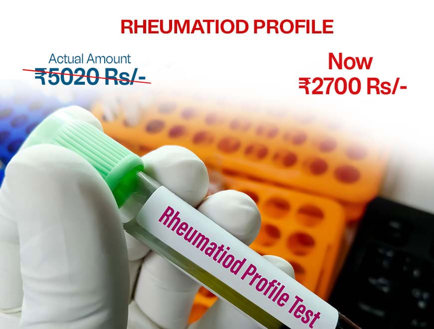 Rheumatoid Profile