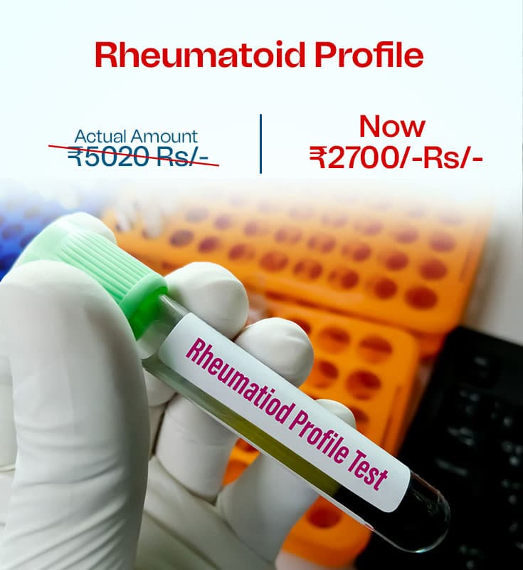 Rheumatoid Profile